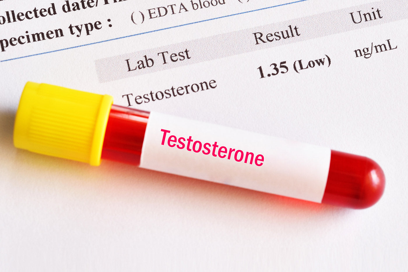 The Testosterone Crash: Why Summer Saps Your Drive (In and Out of the Gym)